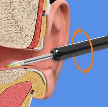 Cargue la imagen en el visor de la galería, StopCerumen - Nettoyeur d&#39;Oreilles
